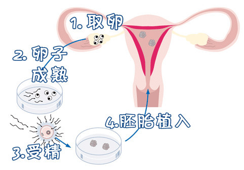 PGT胚胎实验室